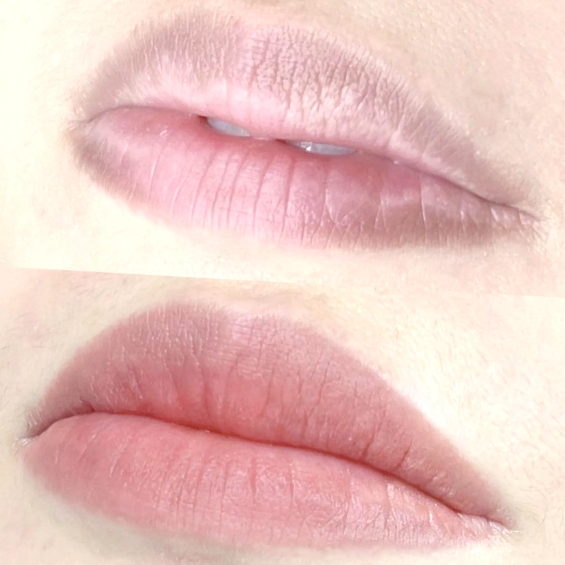 lip tattoo aftercare removal