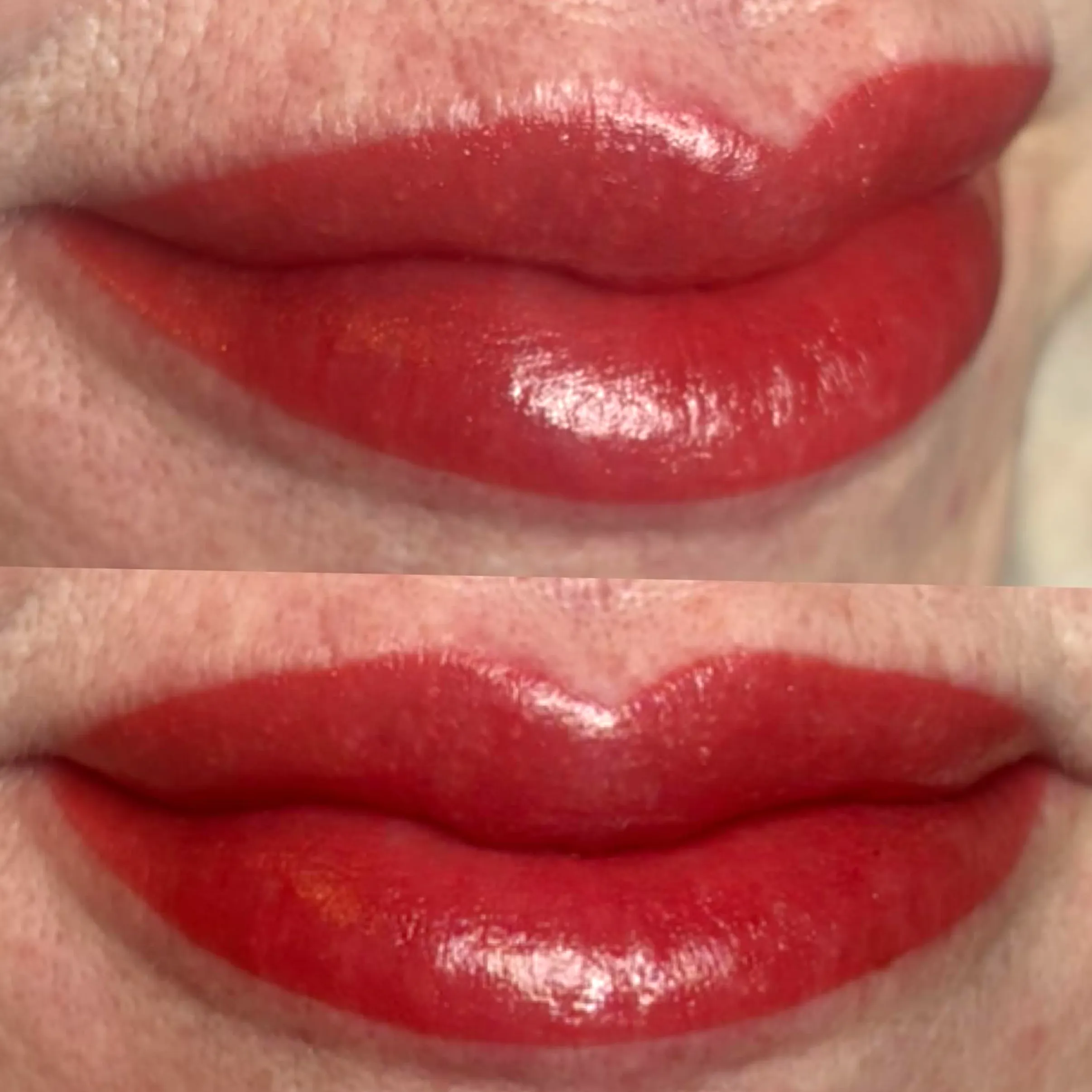 saline removal lip tattoo